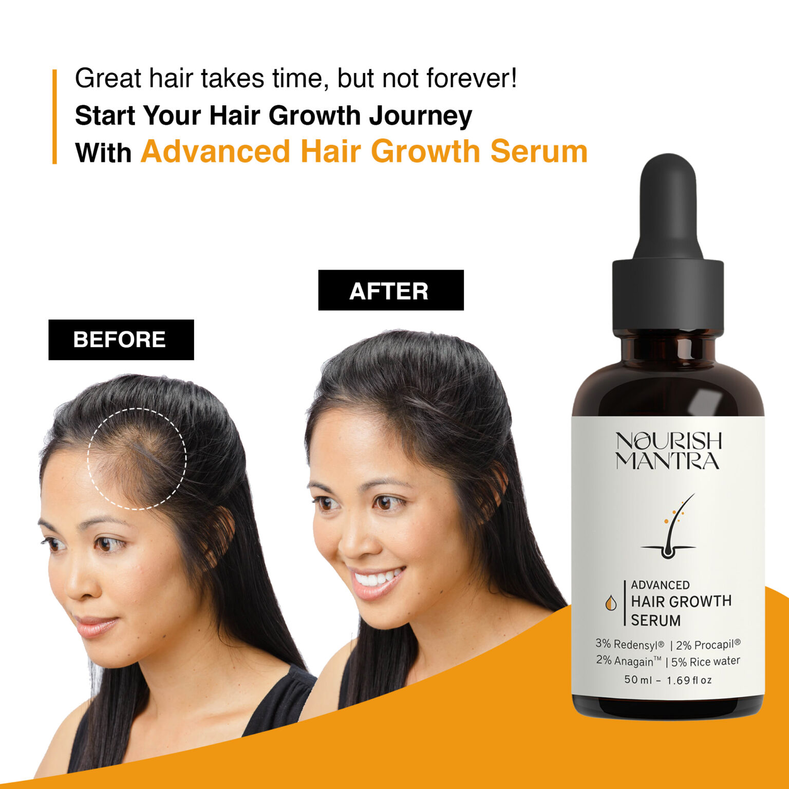 Premium Hair Growth Serum (9500 New Hair in 3 Months) – Uniglam